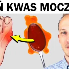 Jak obniżyć kwas moczowy? Sprawdź domowe soki na dnę moczanową