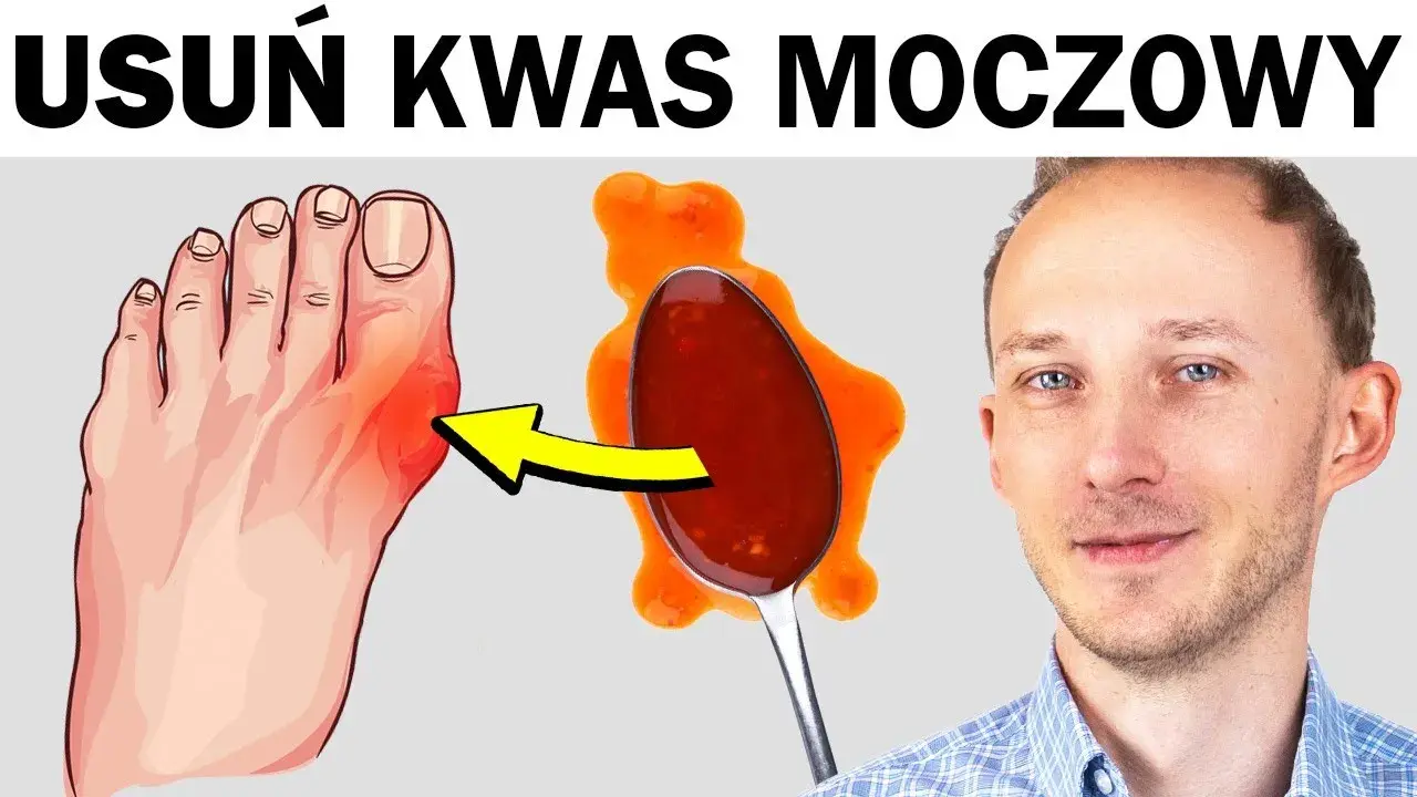 Jak obniżyć kwas moczowy? Sprawdź domowe soki na dnę moczanową
